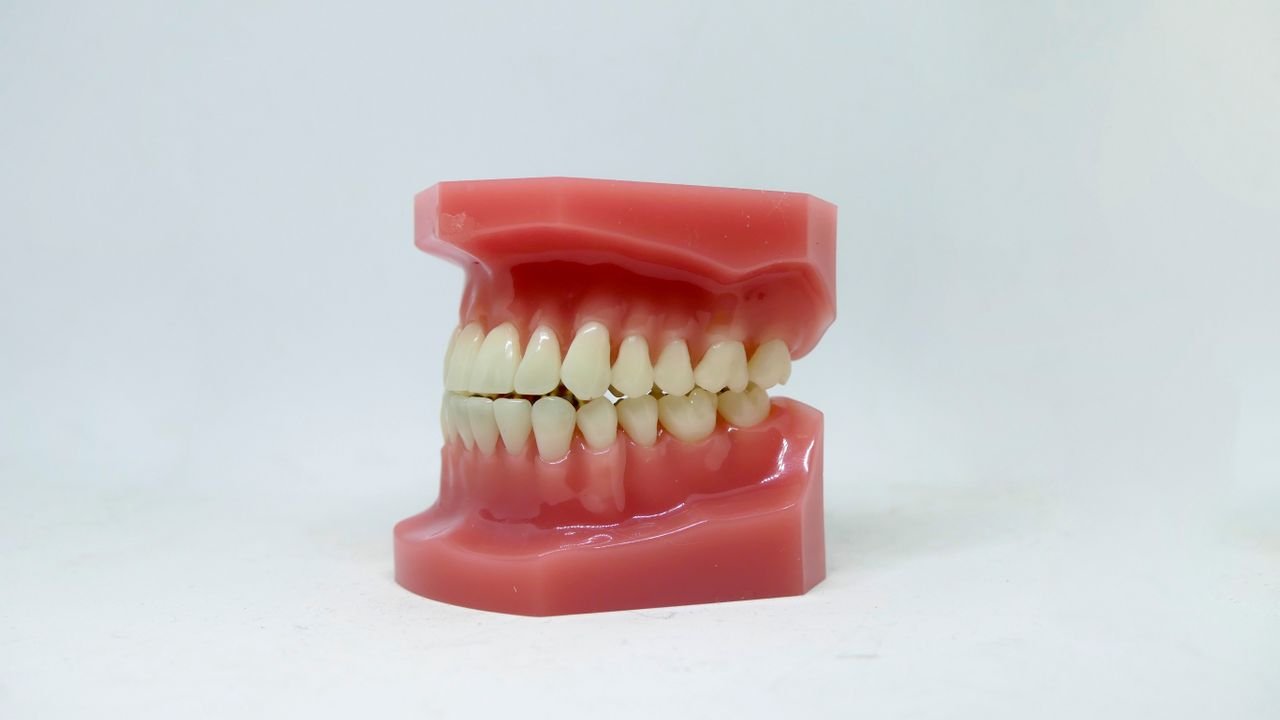 Diş eti ve diş modeli – pembe estetik
